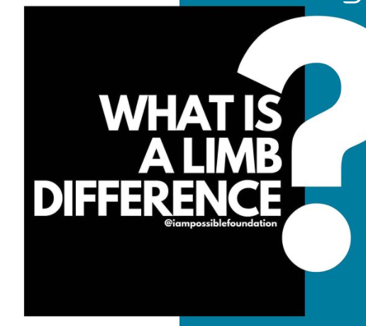 Let’s Talk About Limb Differences